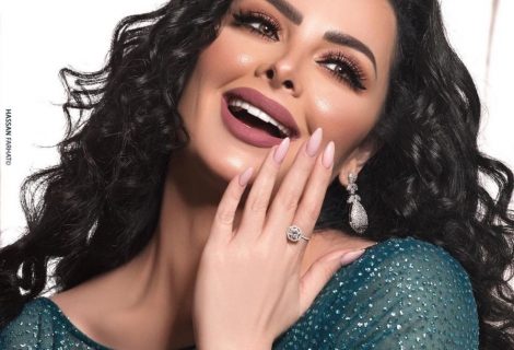حلو الفن - ديانا كرزون تحيي حفلًا غنائيًا في الأردن بمناسبة عيد الحب.. صورة