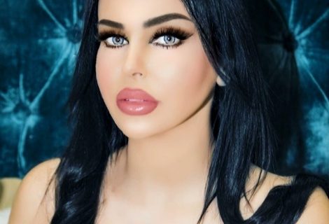 حلو الفن - " بيكفي تجرح " جديد النجمة ألين عبود.. صورة